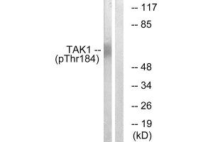 Western Blotting (WB) image for anti-Nuclear Receptor Subfamily 2, Group C, Member 2 (NR2C2) (pThr184) antibody (ABIN1847402) (TR4 anticorps  (pThr184))