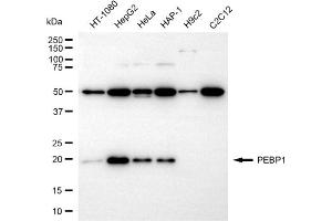 Western blotting analysis using PEBP1 antibody (ABIN7799791).