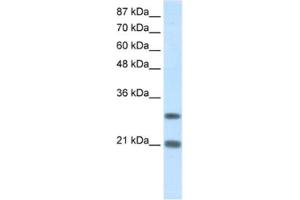 Western Blotting (WB) image for anti-Msh Momeobox 2 (Msx2) antibody (ABIN2461660) (Msx2/Hox8 anticorps)