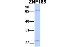 Host:  Rabbit  Target Name:  ZNF185  Sample Type:  MCF7  Antibody Dilution:  1.