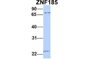 Host:  Rabbit  Target Name:  ZNF185  Sample Type:  MCF7  Antibody Dilution:  1. (Zinc Finger Protein 185 anticorps  (N-Term))