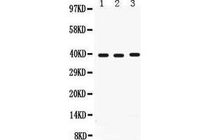 Anti-Midkine antibody, Western blotting All lanes: Anti Midkine  at 0. (Midkine anticorps  (AA 21-143))