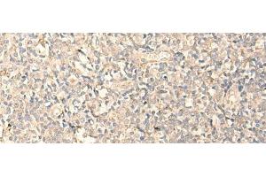 Immunohistochemistry of paraffin-embedded Human tonsil tissue using MPPED2 Polyclonal Antibody at dilution of 1:25(x200) (MPPED2 anticorps)