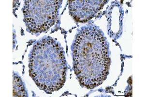 IHC analysis of SAP130 using anti-SAP130 antibody (ABIN7601247). (SAP130 anticorps  (AA 309-913))