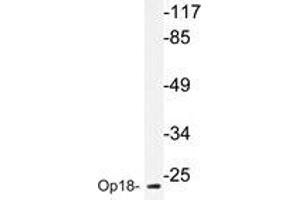 Western blot analyzes of Op18 antibody in extracts from COLO205 cells. (Stathmin 1 anticorps)