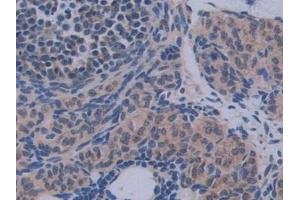Detection of IL12A in Mouse Ovary Tissue using Polyclonal Antibody to Interleukin 12A (IL12A)
