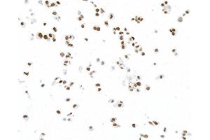 Immunocytochemistry (ICC) image for anti-Paired Box 8 (PAX8) antibody (ABIN7795602) (PAX8 anticorps)