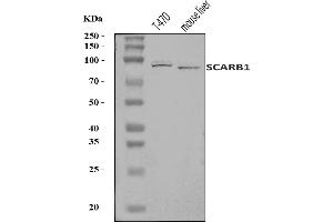 Western blot analysis of Scavenging Receptor SR-BI/SCARB1 using anti-Scavenging Receptor SR-BI/SCARB1 antibody (ABIN7602350).