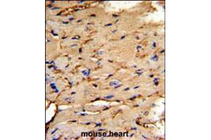 Formalin-fixed and paraffin-embedded mouse heart tissue reacted with PEA-15 Antibody , which was peroxidase-conjugated to the secondary antibody, followed by DAB staining.