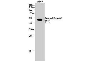 Western Blotting (WB) image for anti-Eukaryotic Translation Elongation Factor 1 Alpha1/Alpha2 (EF-1 Alpha1/2) (acLys41) antibody (ABIN3180430) (EF-1 Alpha1/2 anticorps  (acLys41))