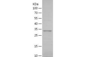 Western Blotting (WB) image for Transmembrane Protein 176B (TMEM176B) (AA 1-65) protein (His-IF2DI Tag) (ABIN7125483)