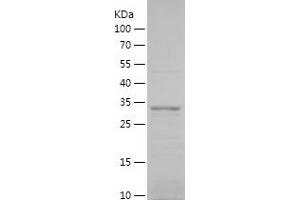 Western Blotting (WB) image for Transmembrane Protein 176B (TMEM176B) (AA 1-65) protein (His-IF2DI Tag) (ABIN7125483) (TMEM176B Protein (AA 1-65) (His-IF2DI Tag))