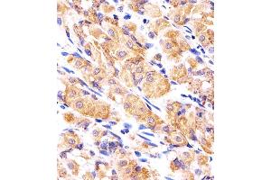 Immunohistochemical analysis of paraffin-embedded H. (RPLP0P6 anticorps  (N-Term))