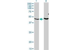 Western Blot analysis of PKNOX1 expression in transfected 293T cell line by PKNOX1 monoclonal antibody (M05), clone 2B3.