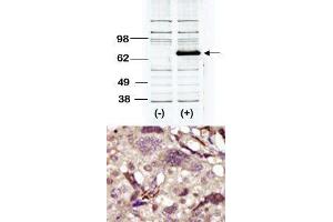 Image no. 2 for anti-Bruton Agammaglobulinemia tyrosine Kinase (BTK) (Middle Region) antibody (ABIN359974) (BTK anticorps  (Middle Region))