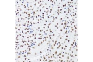 Immunohistochemistry of paraffin-embedded rat kidney using NFKB2 Antibody.