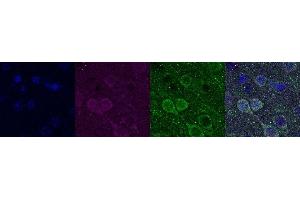 Immunohistochemistry (IHC) image for anti-Ubiquitin Carboxyl-terminal Esterase L1 (Ubiquitin Thiolesterase) (UCHL1) antibody (ABIN7456063)