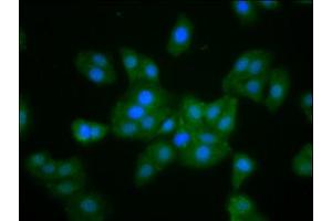 Immunofluorescence staining of HepG2 cells with ABIN7160369 at 1:133, counter-stained with DAPI. (MKLN1 anticorps  (AA 488-614))