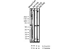Western blot analysis of Phospho-PPAR gamma (Ser112) expression in various lysates