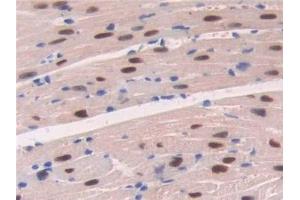 Detection of ADK in Mouse Cardiac Muscle Tissue using Polyclonal Antibody to Adenosine Kinase (ADK)
