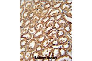 DEGS2 antibody immunohistochemistry analysis in formalin fixed and paraffin embedded human kidney tissue followed by peroxidase conjugation of the secondary antibody and DAB staining. (DEGS2 anticorps  (C-Term))