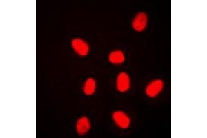 Immunofluorescent analysis of ERK3 staining in HeLa cells. (MAPK6 anticorps  (Center))