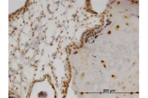 anti-Oligodendrocyte Lineage Transcription Factor 2 (OLIG2) (AA 2-78) antibody