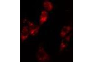 ABIN6279766 staining Hela cells by IF/ICC.