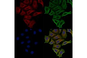 ABIN6257930 and ABIN6274821 staining Hela cells by IF/ICC. (AGXT2L2 anticorps  (C-Term))