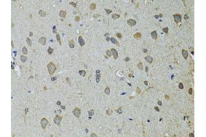 Immunohistochemistry of paraffin-embedded rat brain using UGDH antibody.