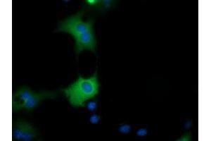 Anti-QPRT mouse monoclonal antibody (ABIN2453570) immunofluorescent staining of COS7 cells transiently transfected by pCMV6-ENTRY QPRT (RC202960). (QPRT anticorps)