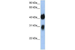 WB Suggested Anti-OTX1 Antibody Titration:  0. (OTX1 anticorps  (C-Term))