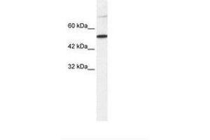 Image no. 1 for anti-T-Box 3 (TBX3) (AA 404-453) antibody (ABIN203221) (TBX3 anticorps  (AA 404-453))