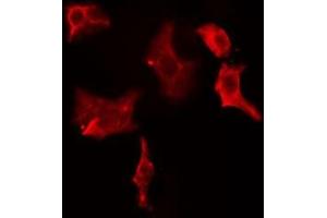 ABIN6274964 staining HeLa cells by IF/ICC. (CBR1 anticorps  (C-Term))