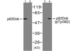 Western blot analysis of extracts from Jurkat cells, using p62Dok (Ab-362) antibody (E021268, Line 1 and 2) and p62Dok (phospho-Tyr362) antibody (E011276, Line 3 and 4). (DOK1 anticorps  (pTyr362))