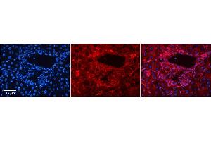 Rabbit Anti-SLC26A1 Antibody  Catalog Number: ARP44029_P050 Formalin Fixed Paraffin Embedded Tissue: Human Adult Liver  Observed Staining: Membrane in hepatocytes; Membrane and Cytoplasm in cells of the portal vein, hepatic arteries and bile ducts, strong signal, wide tissue distribution Primary Antibody Concentration: 1:100 Secondary Antibody: Donkey anti-Rabbit-Cy3 Secondary Antibody Concentration: 1:200 Magnification: 20X Exposure Time: 0.