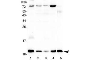 Western blot testing of human 1) U-87 MG, 2) MCF7, 3) A549, 4) HepG2 and 5) mouse testis lysate with DYNLT1 antibody at 0. (DYNLT1 anticorps)