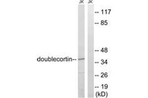 Western blot analysis of extracts from Jurkat cells, using Doublecortin (Ab-376) Antibody. (Doublecortin anticorps  (AA 346-395))
