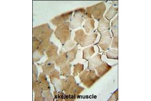 CDKN2C Antibody immunohistochemistry analysis in formalin fixed and paraffin embedded human skeletal muscle followed by peroxidase conjugation of the secondary antibody and DAB staining.