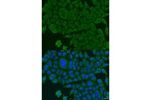 Immunofluorescence analysis of U2OS cells using BCS1L antibody (ABIN2736351) at dilution of 1:100. (BCS1L anticorps)