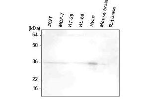 Western Blotting (WB) image for anti-HtrA Serine Peptidase 2 (HTRA2) antibody (ABIN165414) (HTRA2 anticorps)