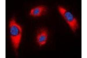 Immunofluorescent analysis of MRPS18C staining in K562 cells.
