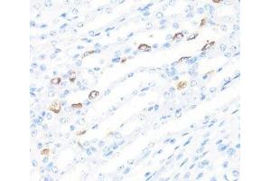 Immunohistochemistry of paraffin-embedded Mouse kidney using FGF10 Polyclonal Antibody at dilution of 1:100 (40x lens). (FGF10 anticorps)