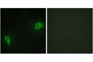 Immunofluorescence analysis of HepG2 cells, using DOK7 Antibody. (DOK7 anticorps  (AA 10-59))