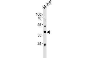 Western Blotting (WB) image for anti-ABI Family, Member 3 (ABI3) antibody (ABIN3004709) (ABI3 anticorps)