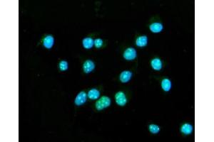 IF analysis of CENPB using anti-CENPB antibody (ABIN7602867). (CENPB anticorps  (C-Term))