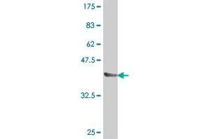 Western Blot detection against Immunogen (37.