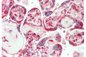 Rabbit Anti-CRIP1 antibody  Formalin Fixed Paraffin Embedded Tissue: Human Placenta Primary antibody Concentration: 1:100 Secondary Antibody: Donkey anti-Rabbit-Cy3 Secondary Antibody Concentration: 1:200 Magnification: 20x Exposure Time: 0.