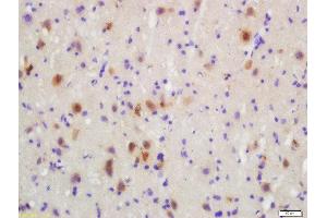 Formalin-fixed and paraffin embedded rat brain labeled with Rabbit Anti-MKK3(Ser218)/MKK6(Ser207) Polyclonal Antibody, Unconjugated  at 1:200 followed by conjugation to the secondary antibody and DAB staining (MAP2K3 anticorps  (pSer207))
