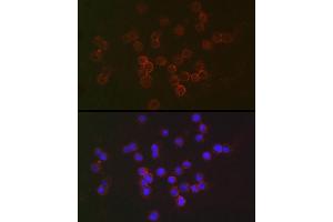 Immunofluorescence analysis of Raji cells using IFN Rabbit pAb (ABIN3015562, ABIN3015563, ABIN3015564 and ABIN6218872) at dilution of 1:50 (40x lens). (IFNAR2 anticorps  (AA 27-243))